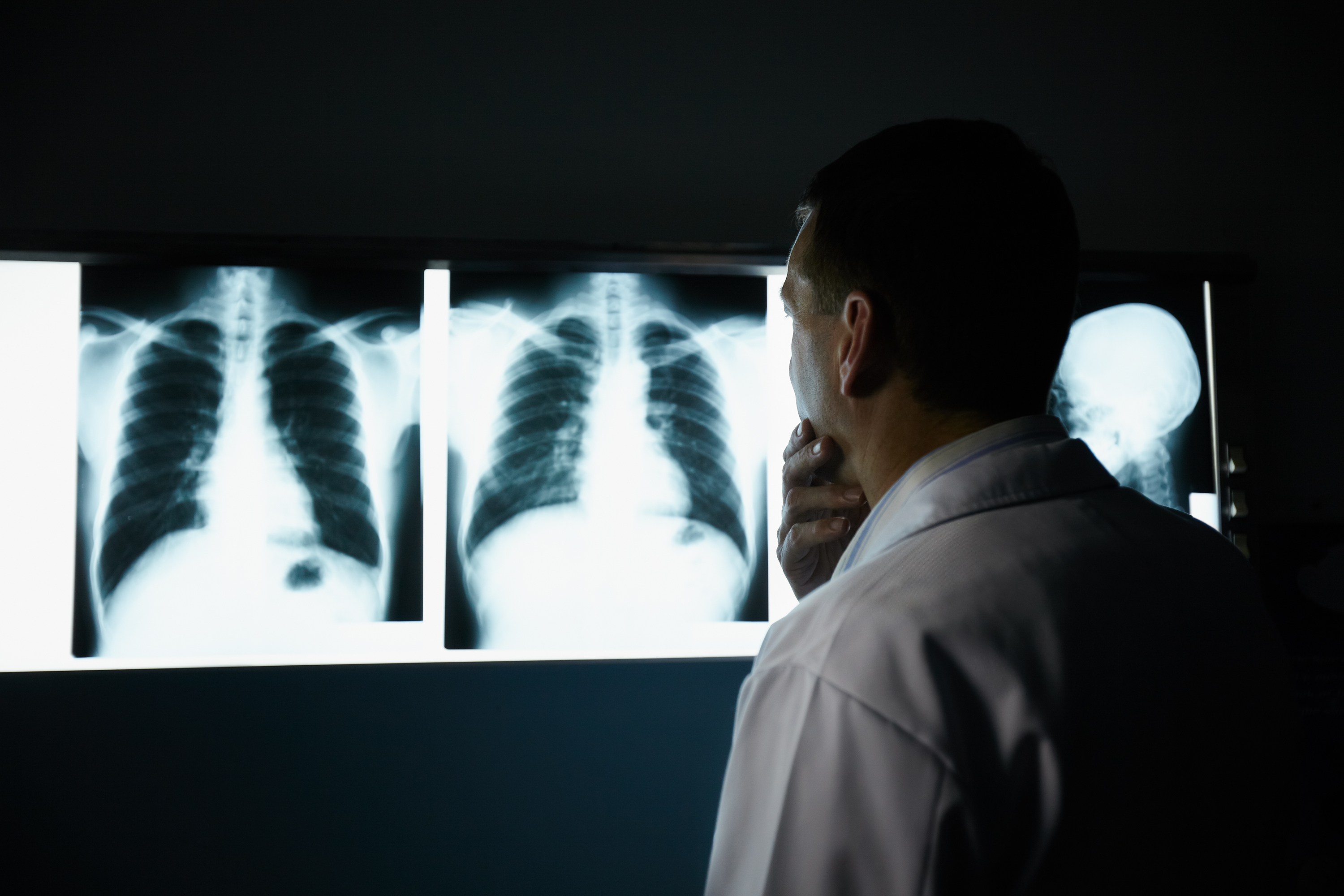 Doctor looking at scan