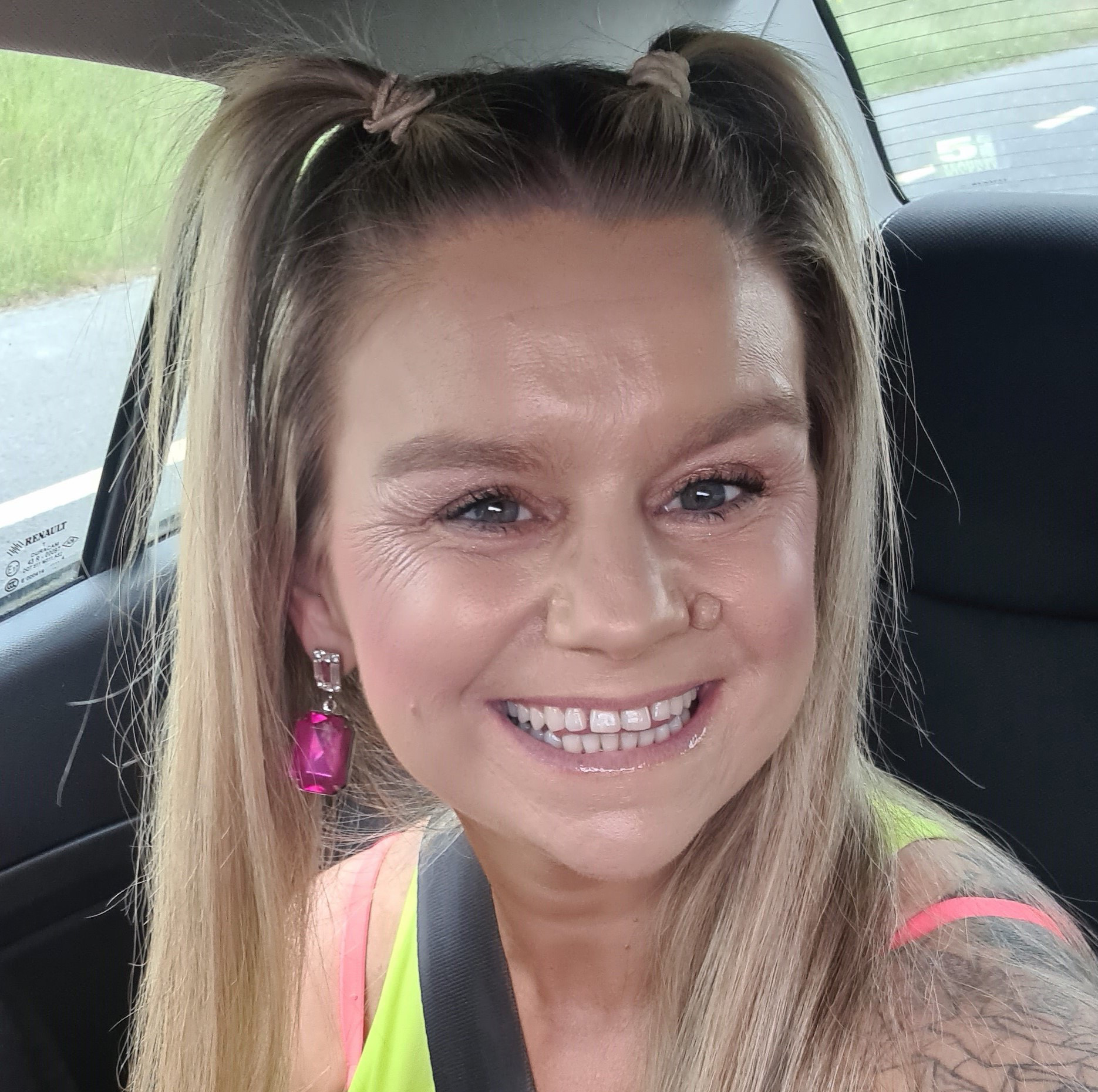 Sharon Felton's breast cancer story