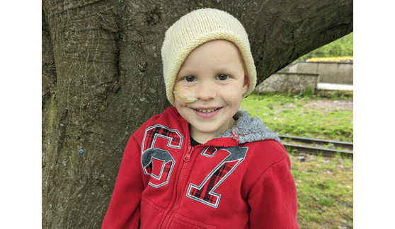 Cadoc's rhabdomy sarcoma story