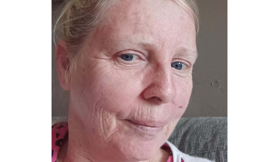 Deirdre Bonass' skin cancer story
