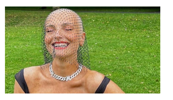 Kristine Kvitsaridze's thymus cancer story