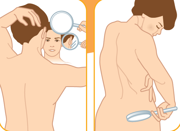 Person examining their skin for changes that could be cancer