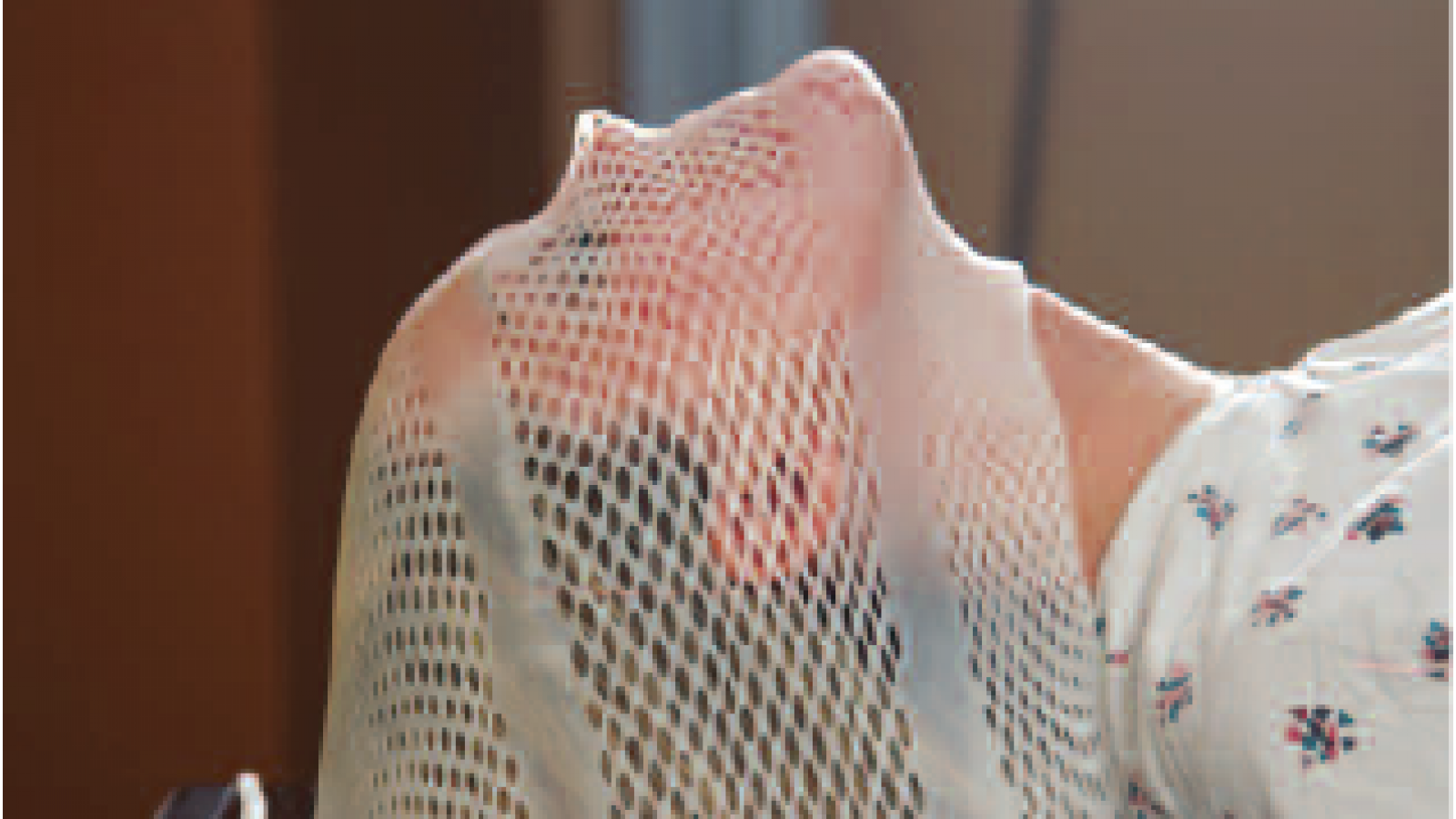 Patient using head radiotherapy mask