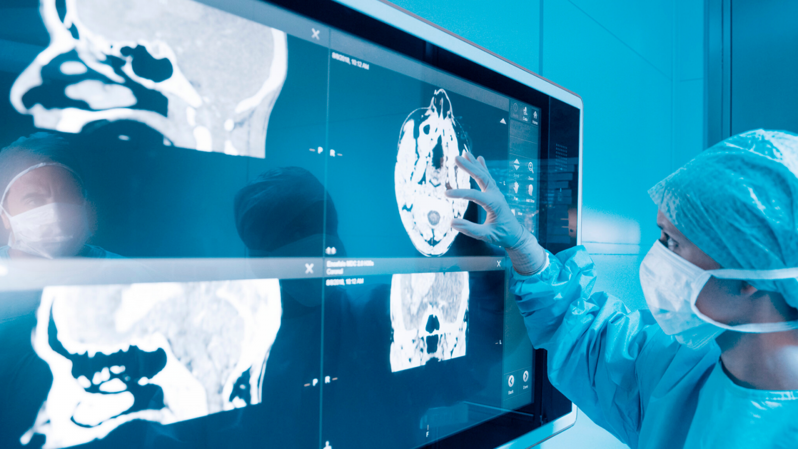 doctor examining brain scans